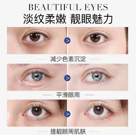 台灣熱銷【眼部救星棒】熱熔霜  急救眼部肌膚問題!KO眼袋·眼紋·眼腫·黑眼圈,連笑容紋都可以一拖即平 台灣熱銷【眼部救星棒】熱熔霜  急救眼部肌膚問題!KO眼袋·眼紋·眼腫·黑眼圈,連笑容紋都可以一拖即平